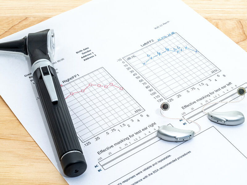 Hearing aids and an otoscope placed on an audiologists desk with an audiogram hearing test chart